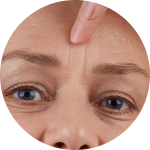 Deep wrinkles have appeared on my forehead.