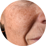 I don’t know what to do with pigmentation.