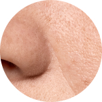I have enlarged pores; I dream of smooth skin.