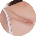 If only this scar could be smoothed out.