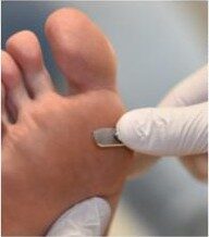 Comprehensive Podiatric Treatment
