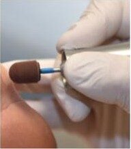 Complementary Dermatological Measures for Nail Fungus Treatment