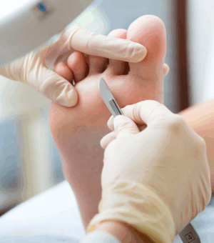 Comprehensive podological treatment