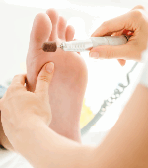 Additional dermatological measures for the treatment of nail fungus