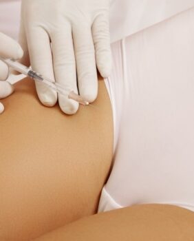 Intieme esthetiek. PlasmaHealth-technologie in het gevoelige gebied
