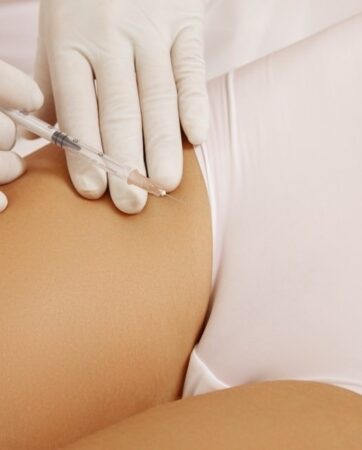 Intieme esthetiek. PlasmaHealth-technologie in het gevoelige gebied