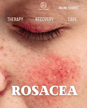 Rosacea. Classical approaches and plasma methods for increasing efficacy 5-fold