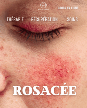 Rosacée. Approches classiques et méthodes plasmatiques augmentant l’efficacité par 5