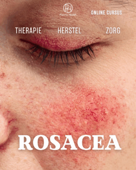 Rosacea. Klassieke benaderingen en plasmamethoden die de effectiviteit vijfvoudig verhogen