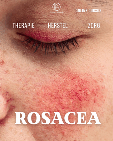Rosacea. Klassieke benaderingen en plasmamethoden die de effectiviteit vijfvoudig verhogen