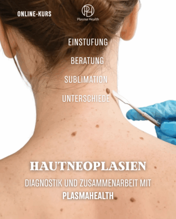 Hautneubildungen: Diagnose und Arbeit mit PlasmaHealth