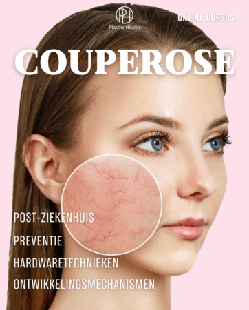 Couperose. Apparatieve en Farmacologische Methoden van PlasmaHealth