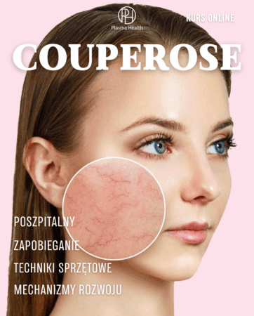 Couperose. Metody aparaturowe i farmakologiczne PlasmaHealth