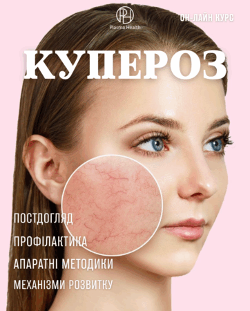 Купероз. Апаратні та фармакологічні методи PlasmaHealth