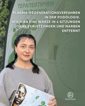 Plasma-Regenerationsverfahren in der Podologie. Wie man eine Warze in 4 Sitzungen ohne Verletzungen und Narben entfernt