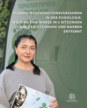 Plasma-Regenerationsverfahren in der Podologie. Wie man eine Warze in 4 Sitzungen ohne Verletzungen und Narben entfernt