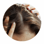 Programs to maintain normal scalp condition, as well as care for dryness, oiliness, and other skin conditions
